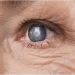Causes of Vision Loss: How to Protect Your Eyesight